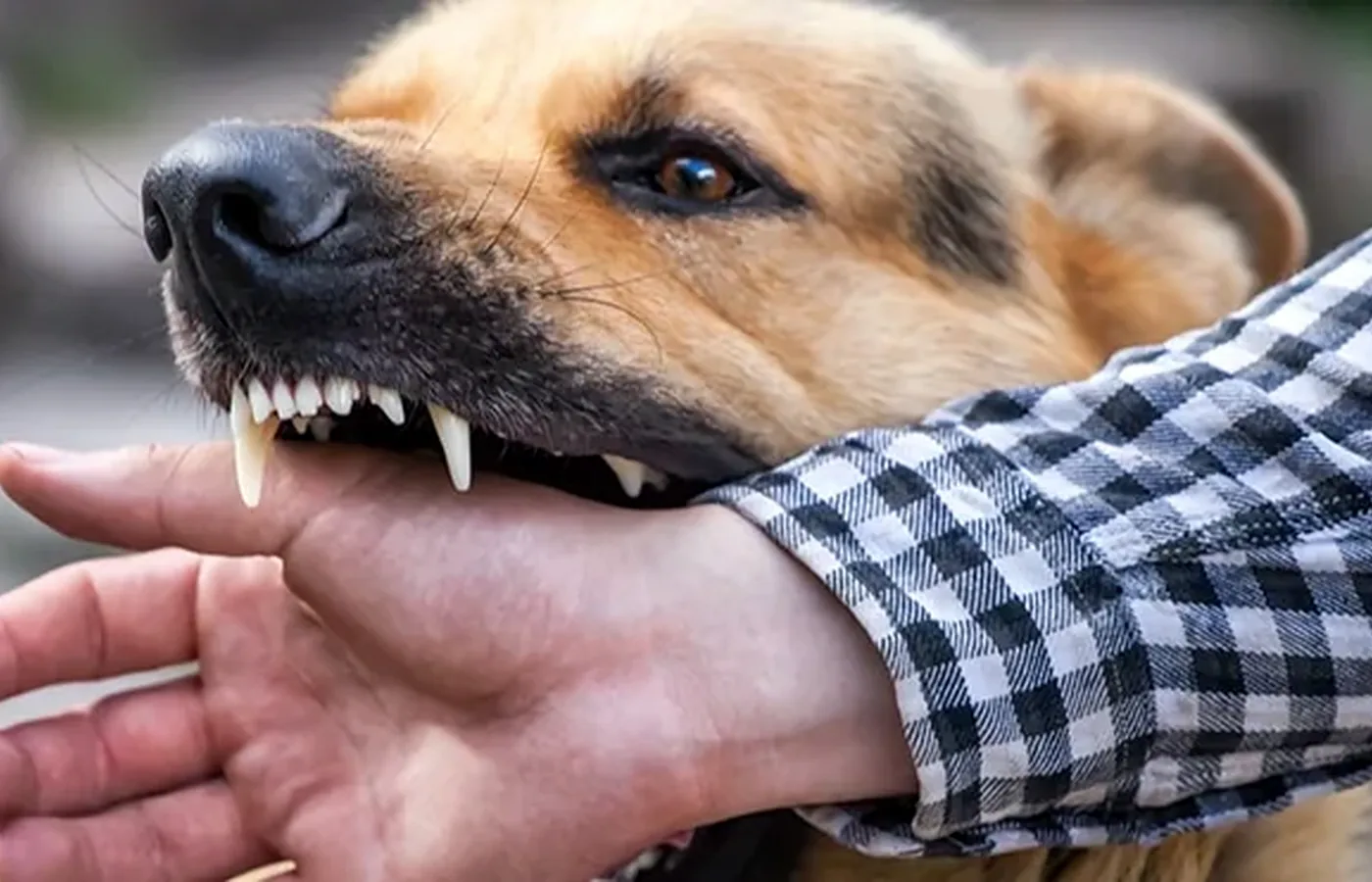 Dog bite incident evidence reviewed for liability and prior history
