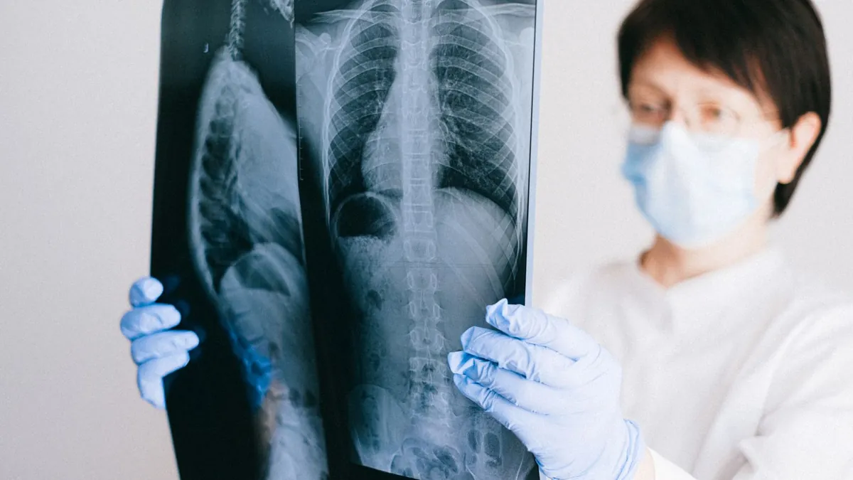 A clinician in gloves and a mask holding up a chest X-ray to review it.